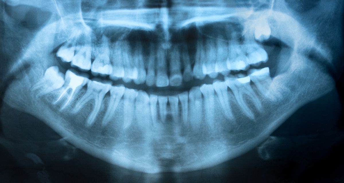 dental xrays during dental services