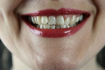 Cosmetic Dentistry Procedures in Tucson